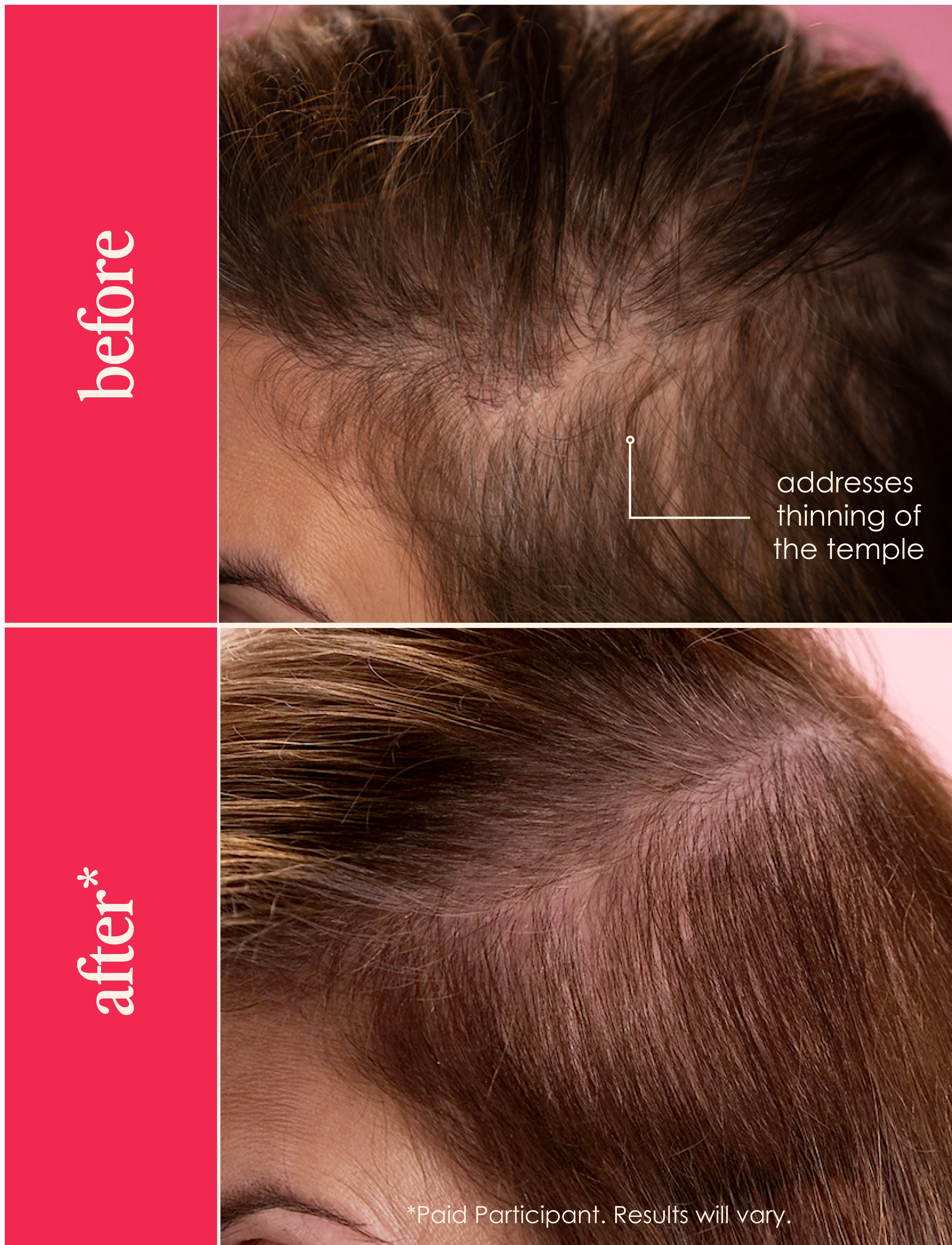 GLP-1 Restore the Lash, Brow & Hair Collection - Image 15